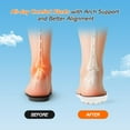 thumbnail image 5 of 4D Cloud-Soft Comfort Soles for Women | Memory Foam Cushioning Insoles with Heel Shock Pad, Trim-to-Fit Arch Support for Foot Pain & Fatigue Relief, 5 of 7
