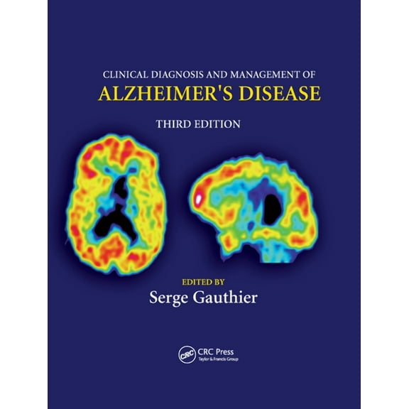 Clinical Diagnosis and Management of Alzheimer's Disease, (Paperback)