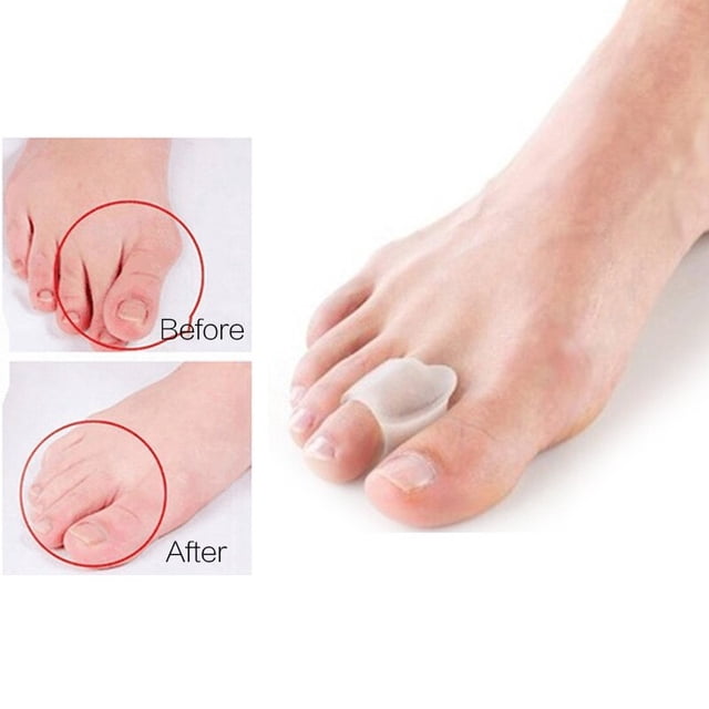 Alisador de dedo gordo del pie, Protector de valgo para pulgar, Gel de silicona, separador de dedos de los pies, ajustador de juanetes, almohadillas para los pies, alivio del dolor en los pies Tan Jianjun unisex