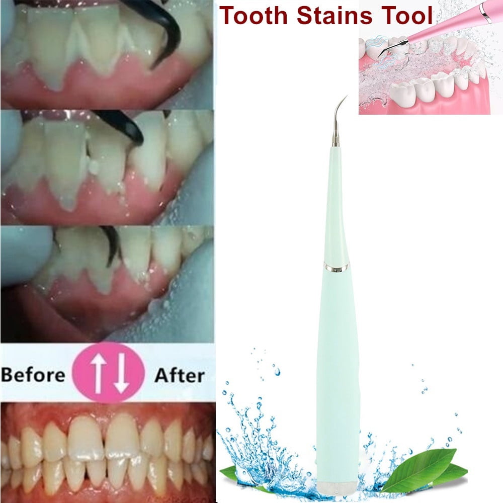 Home zoom teeth whitening