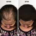 thumbnail image 5 of Finally Hair - Hair Fibers - Refill Bag - Grey - 100 Gram (3.5 oz), 5 of 5