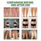 thumbnail image 5 of 20 Pads Cleansing Foot Pads Body Shaping Relieve Swelling Purify Body Remove Toxins Improve, 5 of 5