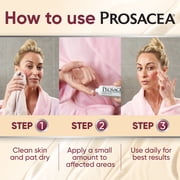 Prosacea Gel for Rosacea Redness, Pimples, and Irritation, Sulphur 1x, 0.75 oz Tube