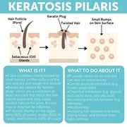 KP Bump Eraser Lotion Keratosis Pilaris Lotion with Glycolic Acid, AHA & BHA Exfoliating Rough & Bumpy Skin Body Lotion