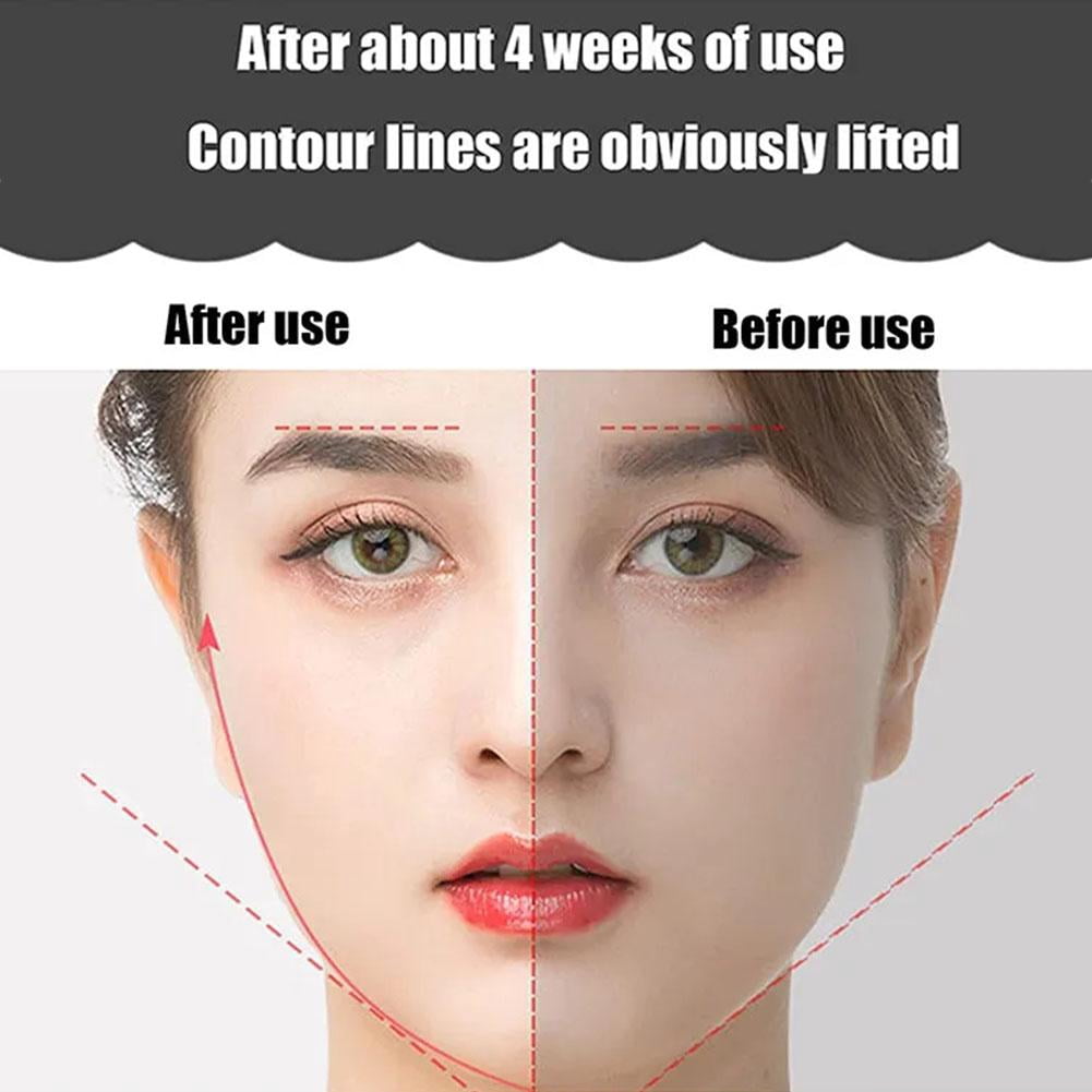 EMS Face Lifting Roller RF Double Chin V Face Shaped Massager Facial LiftUp Y4