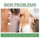 thumbnail image 4 of Jaysuing Anti-Acne Whitening Essence Fades Acne Spots and Marks Moisturizing Whitening Skin Care Essence BF, 4 of 5