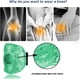 thumbnail image 4 of Xihbxyly Compresa de Gel Caliente y Frío, Doble Uso para Tobillo y Rodilla, Recuperación Rápida de Lesiones Deportivas, Reutilizable y Segura, Colores Modernos, Ideal para Correr y Andar En Bicicleta, 4 of 6