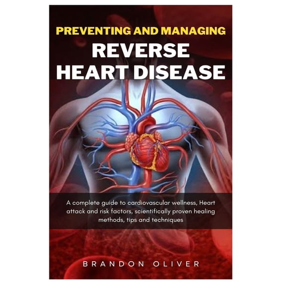 Preventing And Managing Reverse Heart Disease: A Complete Guide to Cardiovascular Wellness, Heart attack and risk factors, scientifically proven healing methods, Tips and Techniques (Paperback)