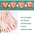 thumbnail image 2 of Gotas potentes para el tratamiento de hongos en las uñas de los pies. Solución antifúngica para las uñas de los pies., 2 of 5