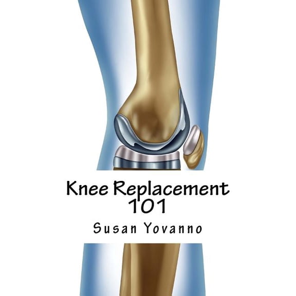 Knee Replacement 101: A User's Guide to Preparation for and Recovery After Knee Arthroplasty, (Paperback)
