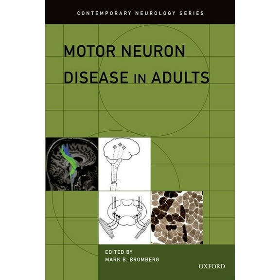 Contemporary Neurology Motor Neuron Disease in Adults, (Hardcover)