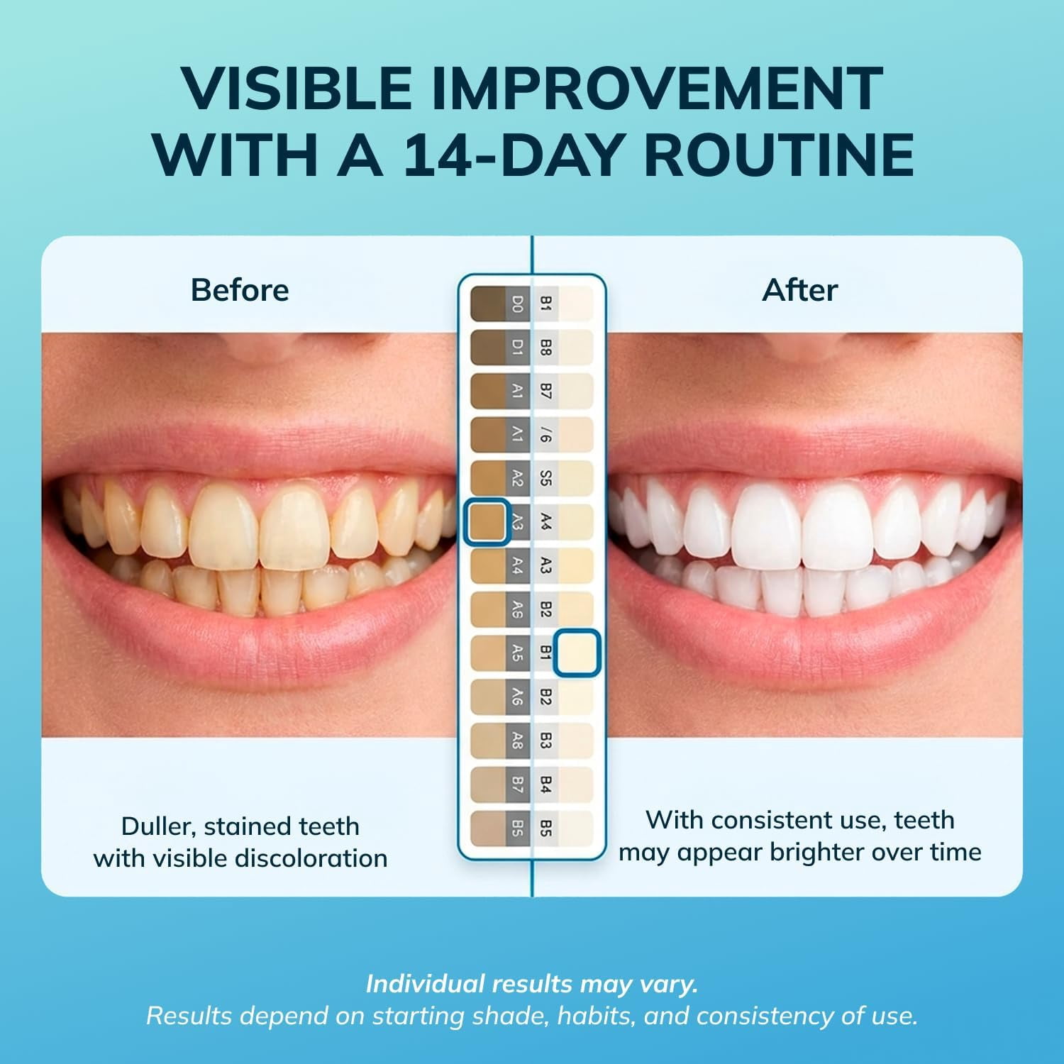 Swissker by Swissklip LED Tooth Whitening Kit — LED Light Kit with Blue Light Activation – Professional Teeth Whitener with Mouthpiece Tray – at Home Teeth Whitening Device System
