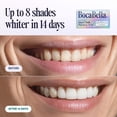 thumbnail image 4 of Tiras blanqueadoras dentales Boca Bella sin peróxido, 7 tratamientos, 4 of 5