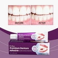 thumbnail image 2 of 1/2/3X Premium Thermoplastic Denture Adhesive Strong Denture Adhesive 40g, 2 of 8