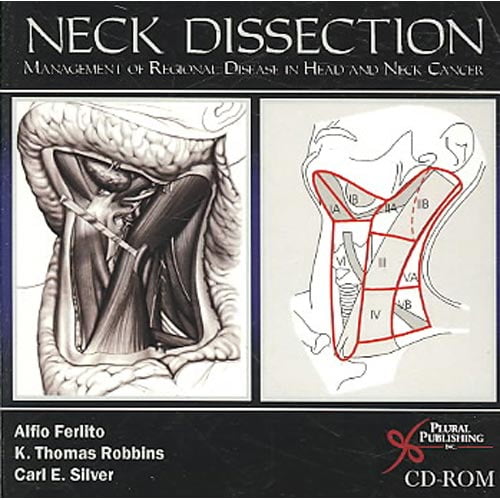 Neck Dissection Management Of Regional Disease In Head And Neck