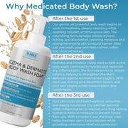 Eczema Body Wash | Sensitive Skin Body Wash Foam | Soothing Cleanser for Eczema Prone Skin | Reduces Dryness & Itching