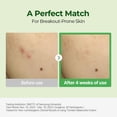 thumbnail image 3 of Crema hidratante Torriden BALANCEFUL Cica Cream para pieles grasas, 3 of 3