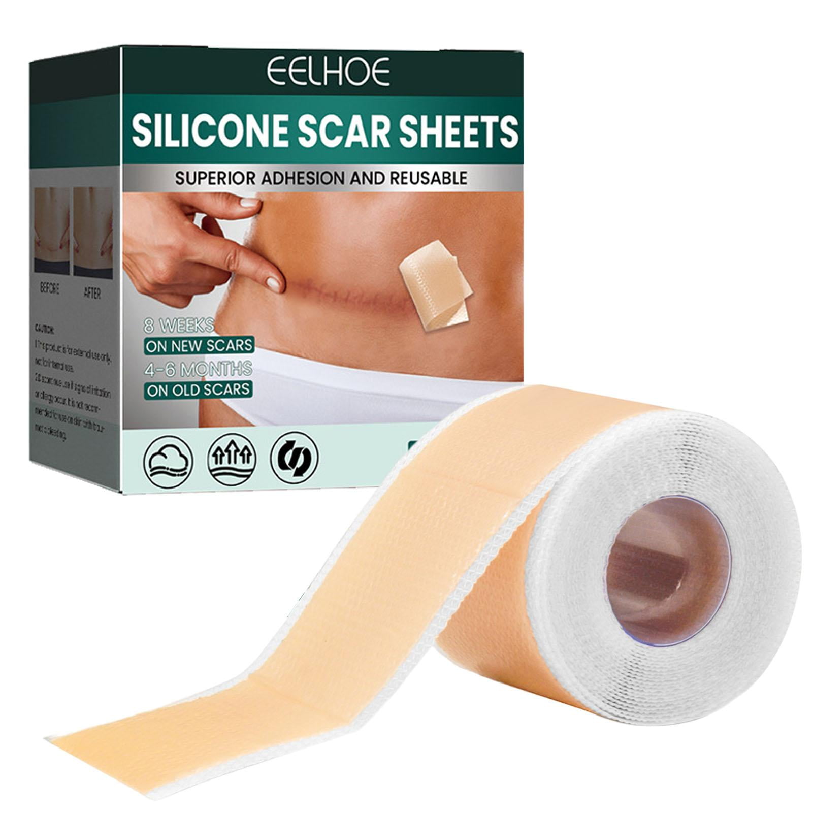 Ankishi Scar Removal Patch SelfAdhesive Silicone Sheets For Scars