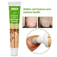 thumbnail image 1 of Tratamiento de uñas de 20g, pomada para eliminación de onicomicosis, paroniquia, cuidado de los dedos de los pies, solución de hongos para uñas Toenai, 1 of 3