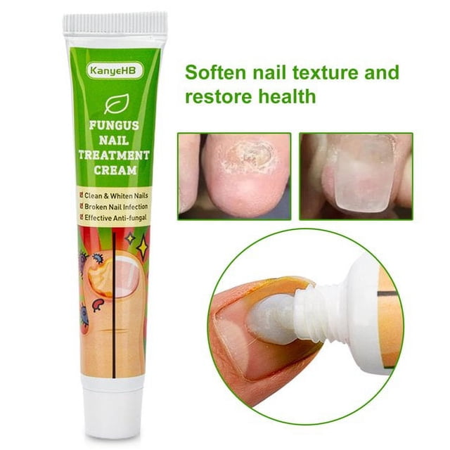Tratamiento de uñas de 20g, pomada para eliminación de onicomicosis, paroniquia, cuidado de los dedos de los pies, solución de hongos para uñas Toenai