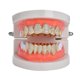 thumbnail image 2 of Oro AA Sunnimix Tapas para parrillas de dientes de boca, 2 of 8