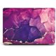 thumbnail image 1 of Estuche Berkin Art para portátil de 15" Rosoft Surface 5/4/3, modelos 2022, 2021 y 2019, de metal, Palm, modelos 1872/1873/1953/1979, 1 of 4
