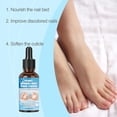 thumbnail image 5 of Herbal Toenail Soothing Drops for Fungus, Antifungal Treatment for Discolored Nails, Natural Relief Oil for Ingrown – 10ml, 5 of 7