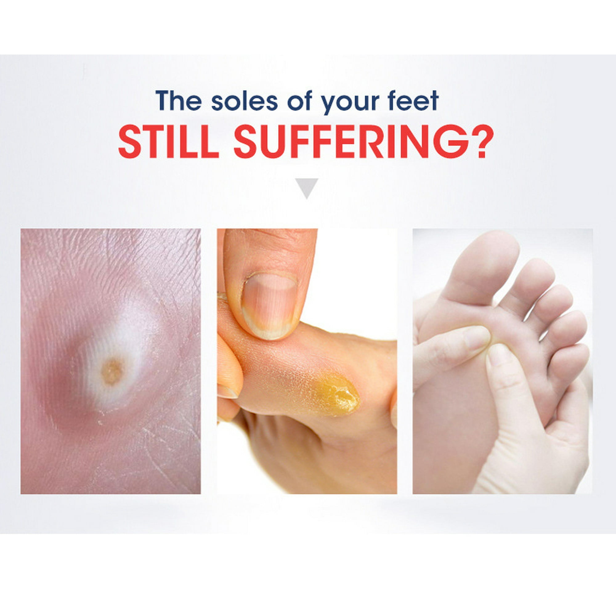 24 Pcs Corn Pads, Toe Callus Removal, One Step Corn Patch, Pain