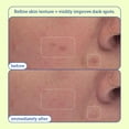 thumbnail image 4 of Almohadillas exfoliantes Skinfix Resurface+ AHA/BHA Niacinamida 60 almohadillas, 4 of 8