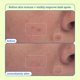 thumbnail image 4 of Almohadillas exfoliantes Skinfix Resurface+ AHA/BHA Niacinamida 60 almohadillas, 4 of 8