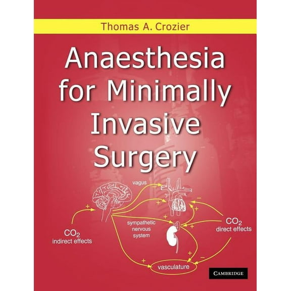 Anaesthesia for Minimally Invasive Surgery, (Paperback)