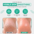 thumbnail image 2 of CLEAR 40 Urea Cream 40 Percent for Feet Maximum Strength (4oz) | Softens Cracked Heels & Dry Skin Urea Cream 40 Percent - Tea Tree & Coconut Oil | Urea Cream for Callus & Corn Treatment | Made in USA, 2 of 7