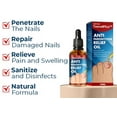 10ml Anti Paronychia Relief Oil, Repair Ingrown Toenail Thickening