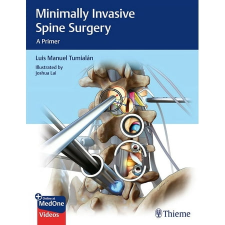 UPC: 9781626232181 | Minimally Invasive Spine Surgery: A Primer (Hardcover)