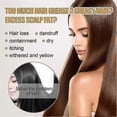 thumbnail image 5 of New Ginger Shampoo Soap Shampoo Soap Black Hair Black Hair Removes Mite, 5 of 5