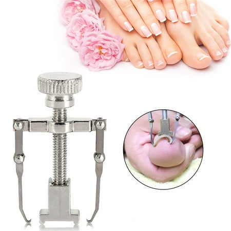 Foot Nails Care Tool Toe Nail Recover Correction Tool Pedicure Toenail Fix for Curing Paronychia Ingrown Toe (Best Cure For Ingrown Toenail)