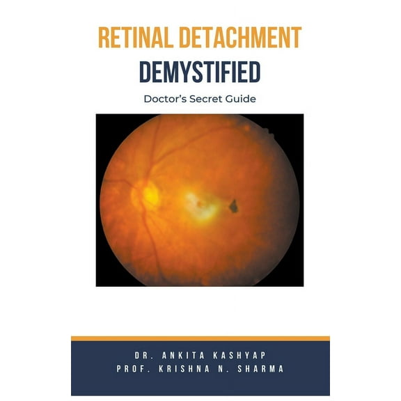Retinal Detachment Demystified: Doctor's Secret Guide, (Paperback)