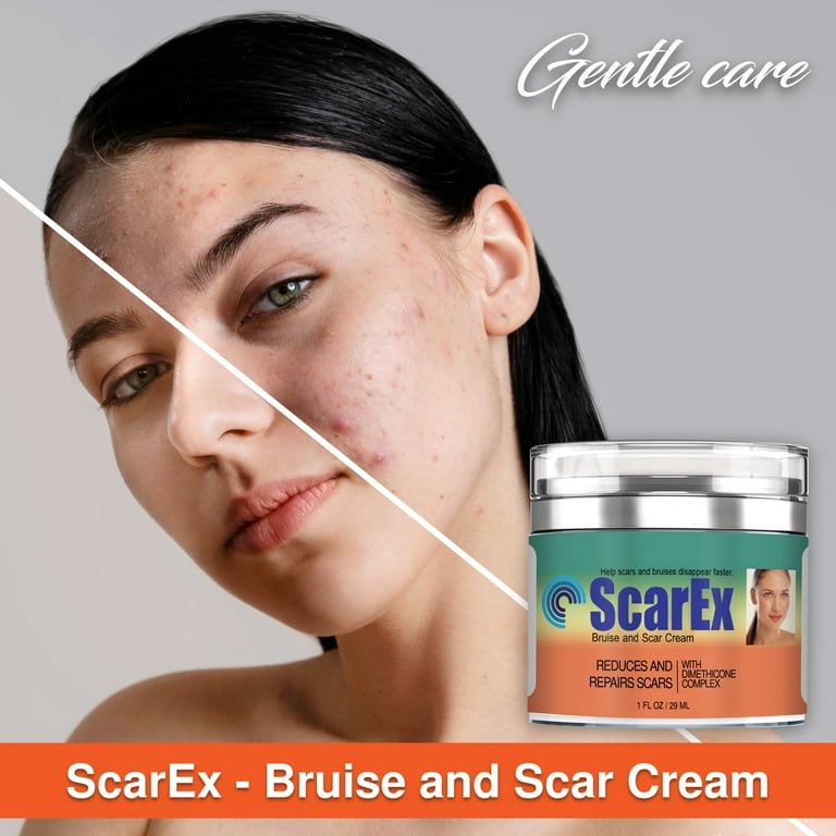 Scar-Ex Cream for Women and Men Rapid Repair of New Old