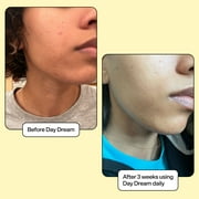 Bubble Skincare Day Dream Serum with Vit C & Niacinamide, Even Tone & Dark Spots, All Skin Types, 1 fl oz / 30ml