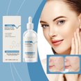 thumbnail image 4 of Fiudx Esencia Exfoliante, Suero Calmante y Suavizante, Hidratante Antiimperfecciones, Loción Refrescante con Control de Grasa, Cuidado para Piel Sensible, 100 Ml, 4 of 6