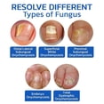 thumbnail image 3 of Dispositivo láser para hongos en las uñas, tratamiento antimicótico para onicomicosis, el más vendido, 2024, 3 of 5