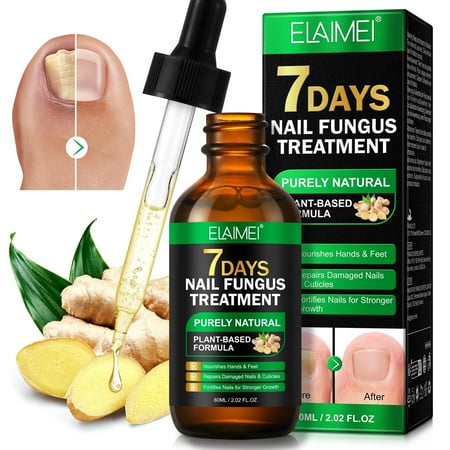 Elaimei 7-Day Nail Fungus Care Serum, Ginger-Infused Nail Repair Oil for Hands & Feets Care, Repairs Damaged Nails & Cuticles 2.02 fl.oz