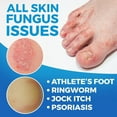thumbnail image 6 of Imperial Feet Antifungal Skin Cream - Athletes Foot Treatment - Jock Itch Cream Extra Strength - Ringworm Treatment for Humans - XL - Used by Professionals, 6 of 8