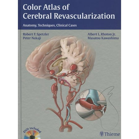 UPC: 9781604068221 | Color Atlas of Cerebral Revascularization: Anatomy  Techniques  Clinical Cases (Other)