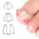 thumbnail image 1 of Gancho de clavo frontal/banda de goma Herramienta de corrección de uñas encarnadas Clips de ortesis Ndcxsfigh Cuidado Belleza, 1 of 5