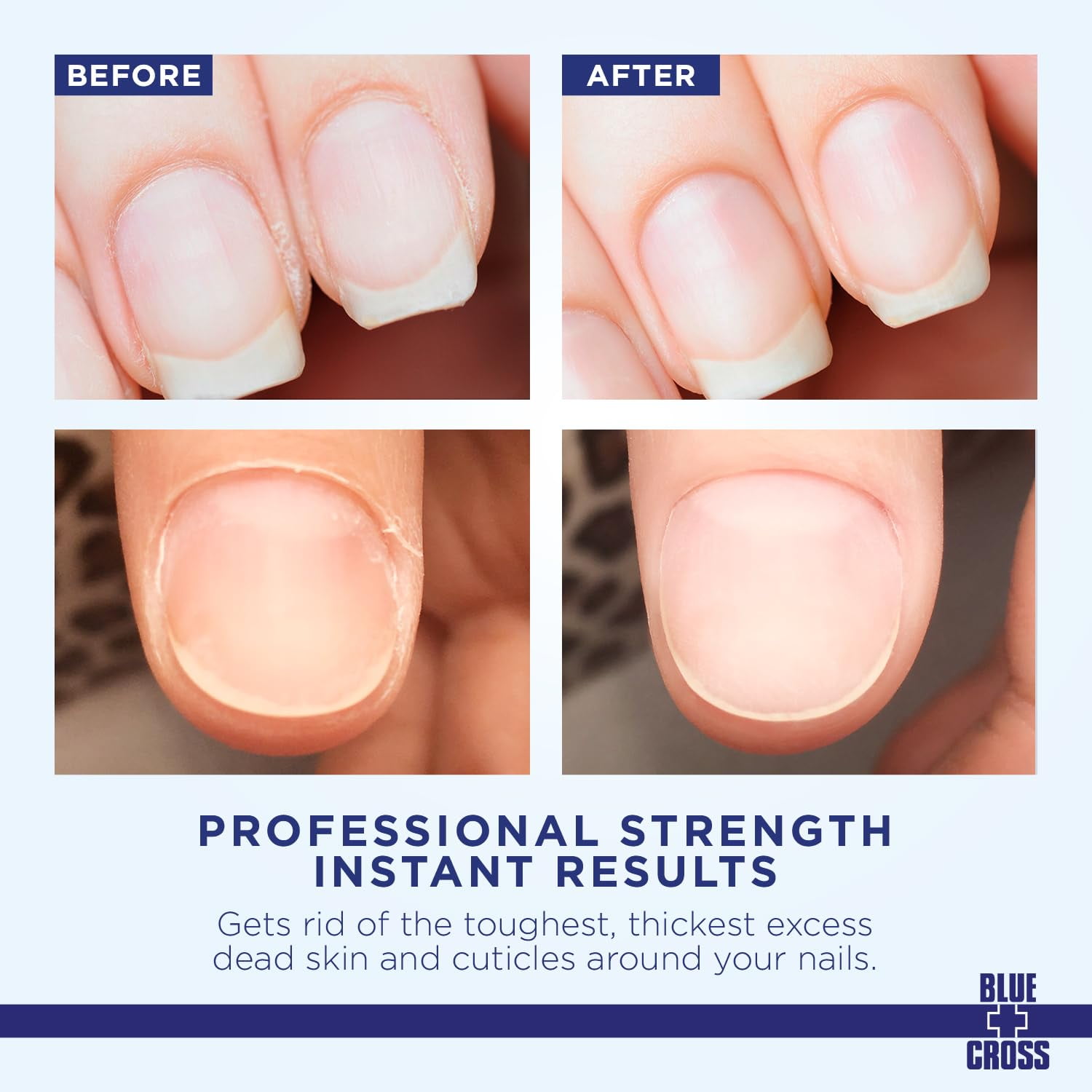(2 pack) Blue Cross Cuticle Remover Cream 2 fl. Oz.