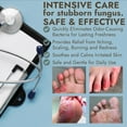 thumbnail image 3 of Tea Tree Oil Antifungal Foot Gel | Relieves Jock Itch, Athlete’s Foot & Ringworm | Soothes Itching & Burning | Moisturizes Dry, Cracked Feet | No-Touch Applicator | 1-Week Treatment Option | 20g, 3 of 8