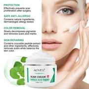 ALIVER Scar Cream, Stretch Marks Remover, Ideal for Acne, C-Section, Burns, Surgical Scars Treatment, Effective for Old and New Scars, 1.7 oz