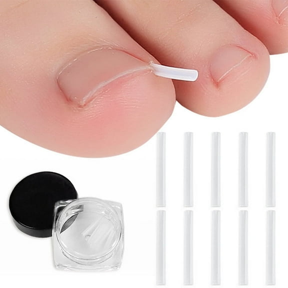 10PCS Ingrown Toenail Corrector Strips, Professional Curved Brace Toenails Correction Tool Straightening Recover Clips with Box for Women Men Foot Care