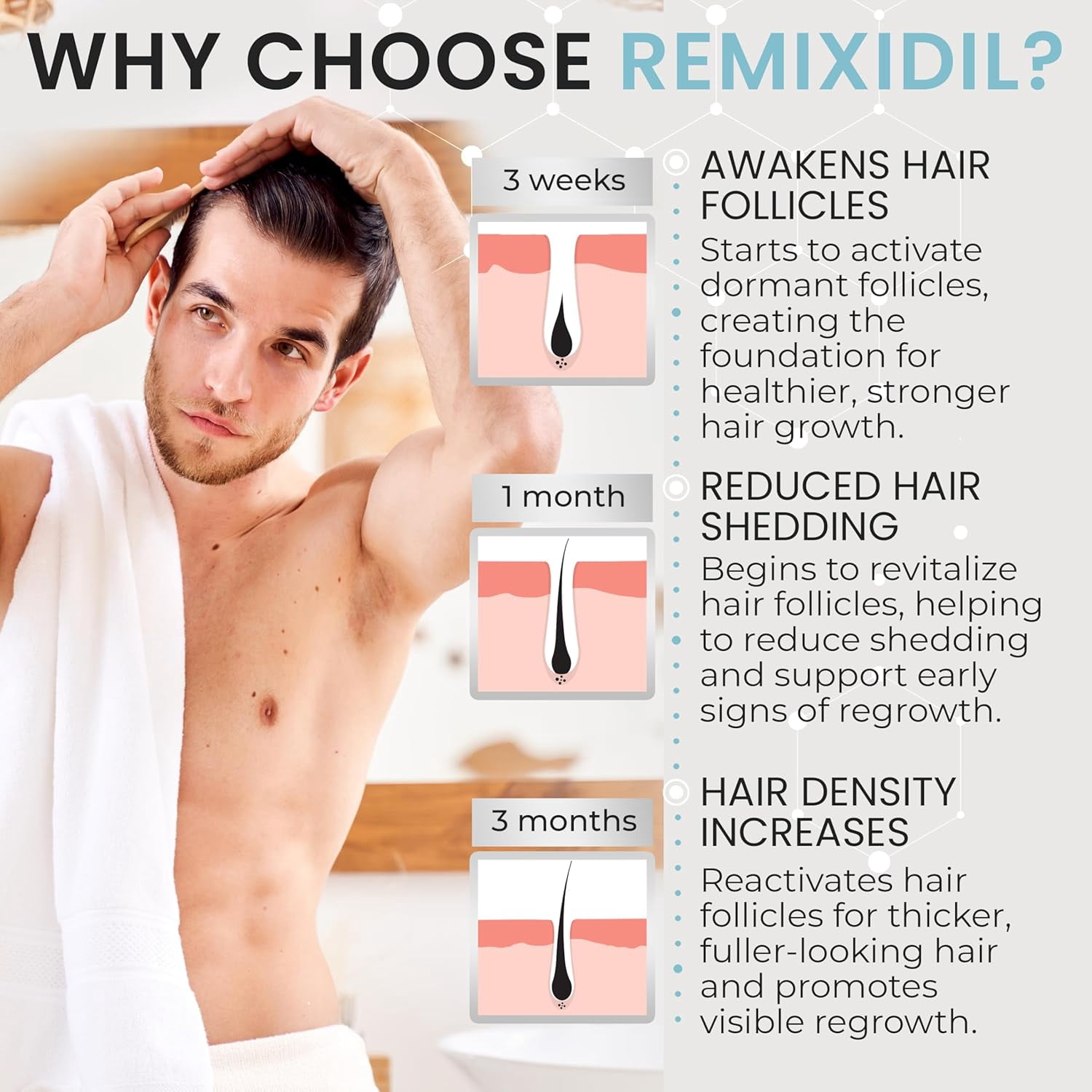 Men’s 5% Scalp Solution | Daily Leave-On Treatment for Thicker, Fuller-Looking Hair